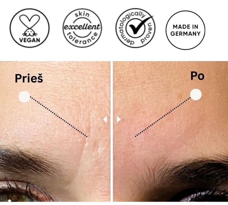 Pleistro nuo raukšlių poveikis odai. Kaip išlygintos raukšlės. 