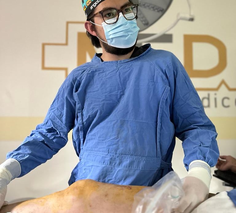 Cirugía Laser para Varices (EVLA)