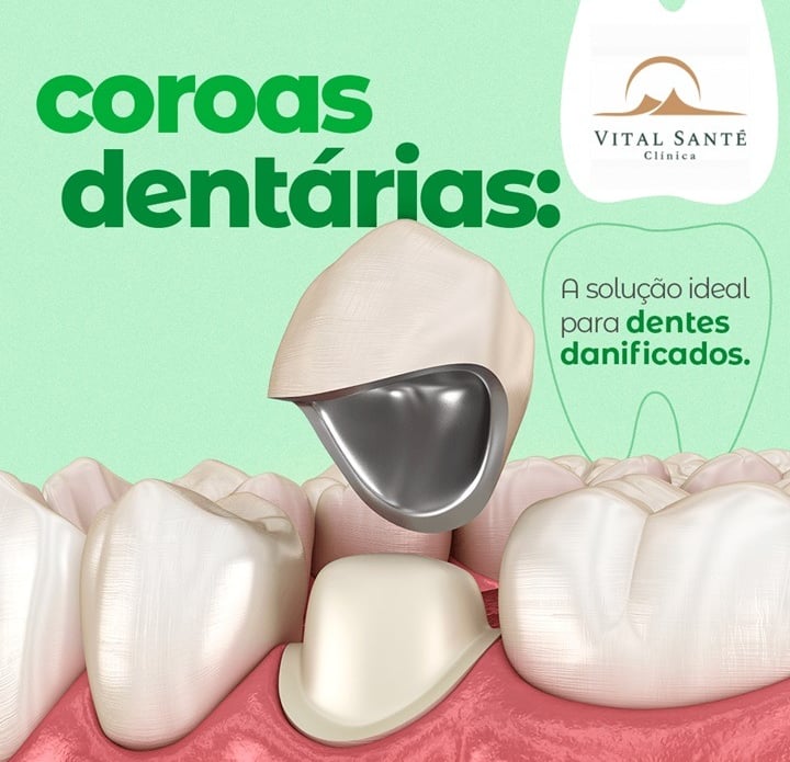 prótese dentária recreio