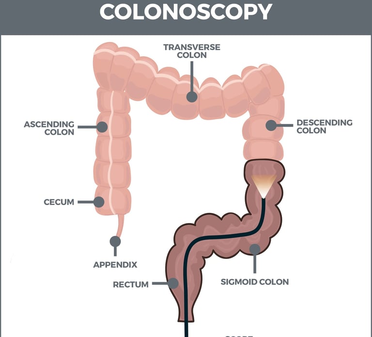 GASTRO FOUNDATION colonoscopy