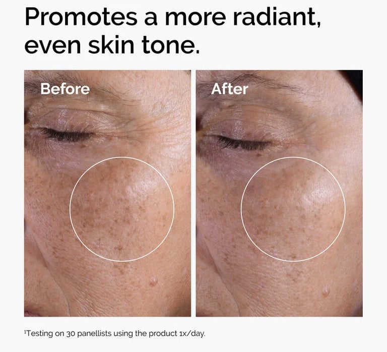 Before and after photo showing reduced pigmentation and more even, radiant skin tone around the eye 