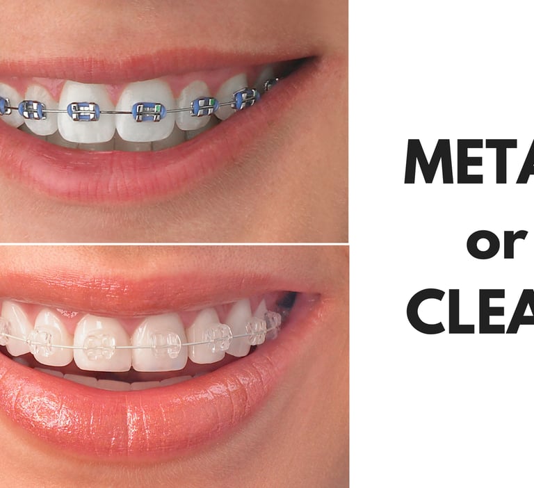 Orthodontic Treatment at dentosculpt