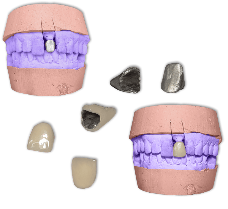 Protesis Fija Metal Ceromero Signum