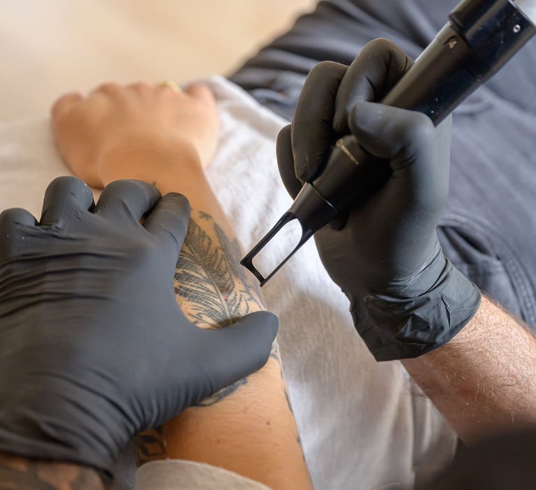 Tattoolaser Unterarm vorne
