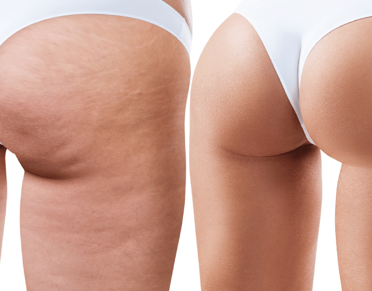 a woman with a very large butt buttocks