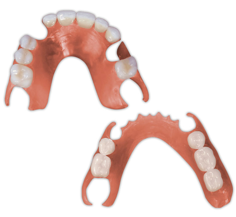 Protesis-Removible-Flexible-PartialFlex