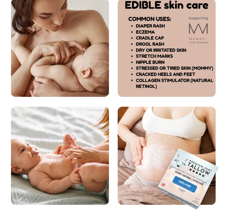 Infographic for Premium Suet Tallow Balm listing benefits: dry or irritated skin, stretch marks, nip