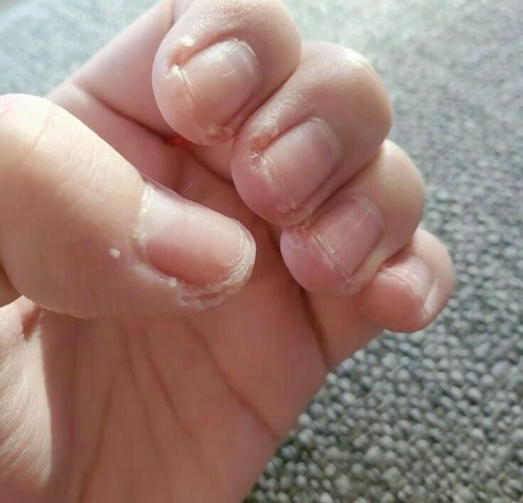 roer unhas