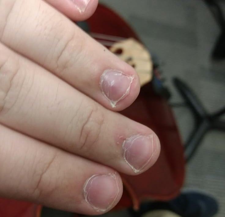 roer unhas