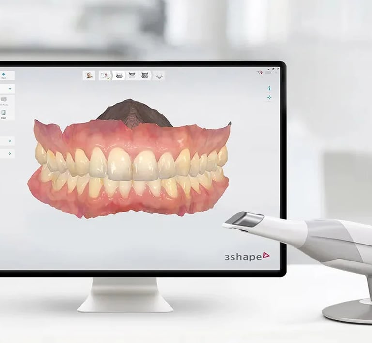 3Shape dental intraoral scanner and monitor displaying a detailed 3D digital impression of human teeth.