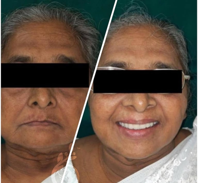 Olīva Dental - Complete Dentures