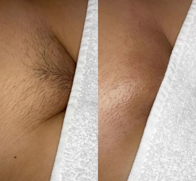 Brazilian Wax - New Gen Studio - Worthington, MN