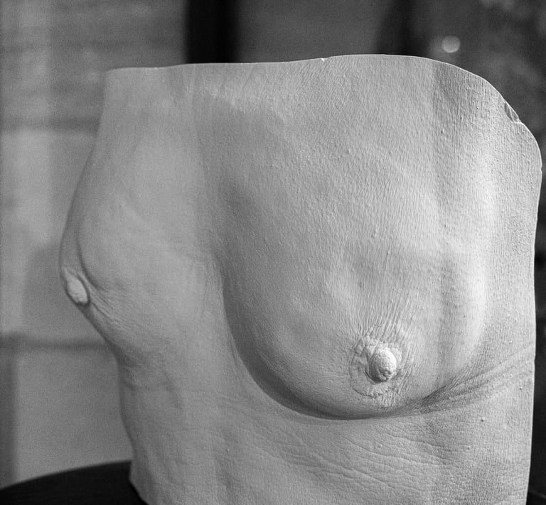 Moulage femme atteinte du cancer du sein