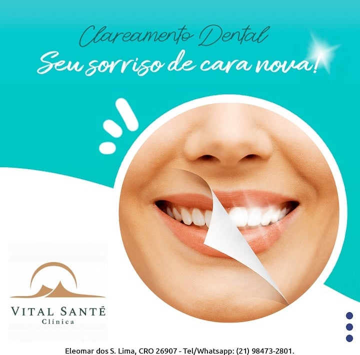 clareamento dentário dental dentista recreio