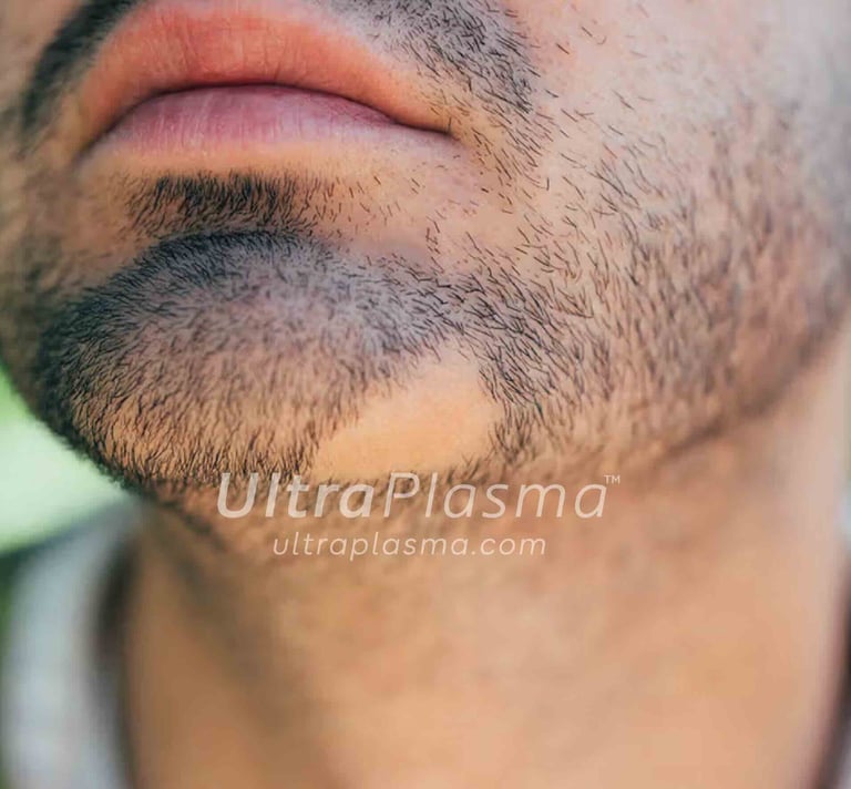 _ultra_plasma_ultra_plazma_ultra-plasma_ultra-plazma