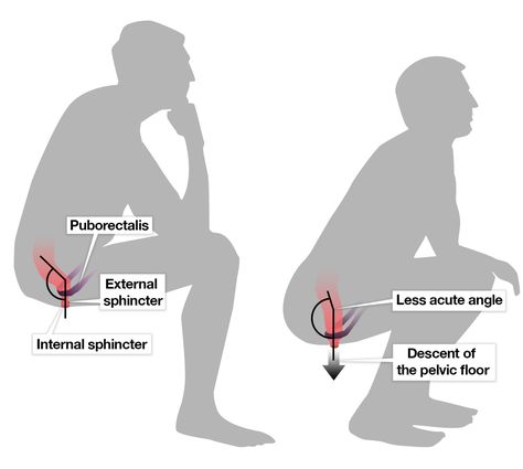 Good toilet posture 