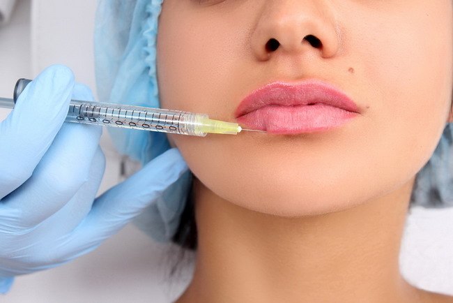 a woman getting her lips filler