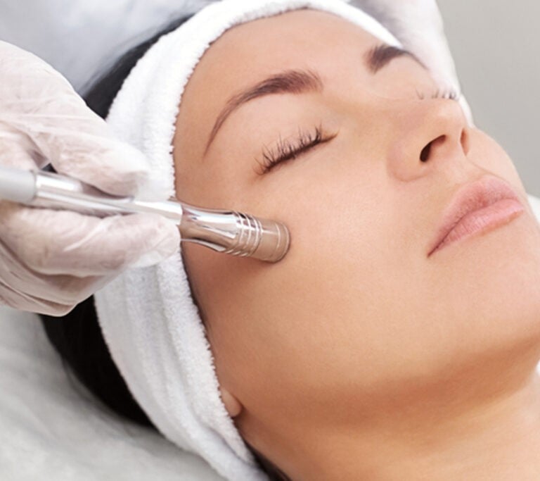 a woman getting a microdermabrasion