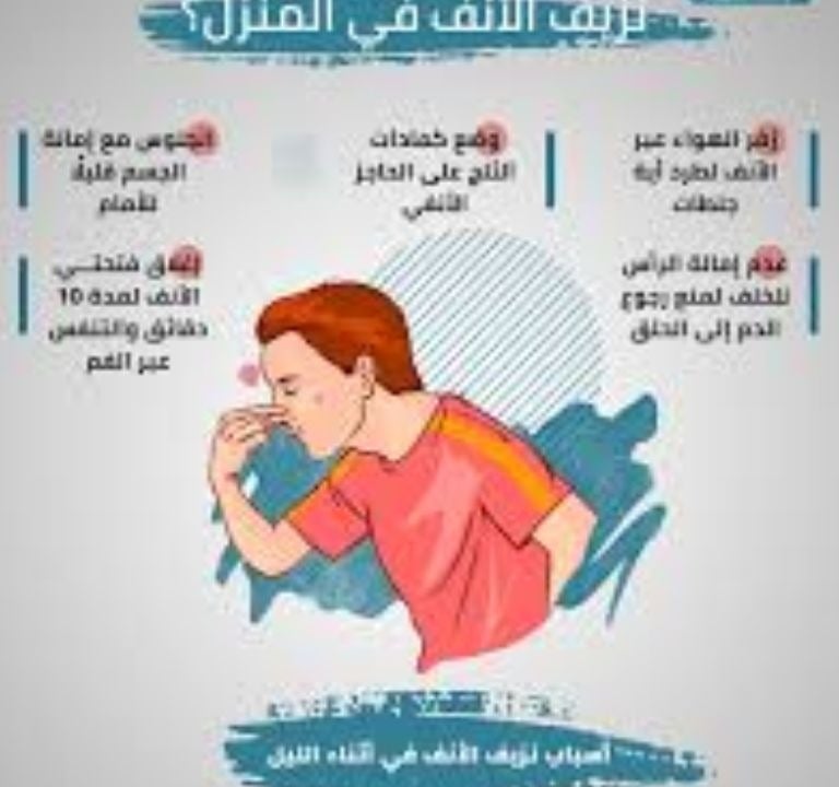   بنفسك علاج النزف