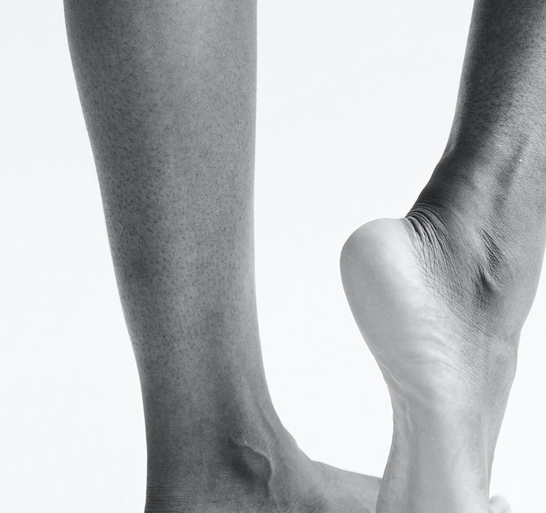 Tratamiento radiofrecuencia (piel, flacidez) en Murcia. Clinica de medicina estética para mujer