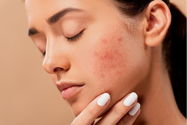 hyaluronic acid may cause redness , skin itching ,bruising.