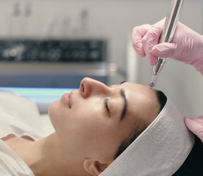a woman is getting her face microneedled