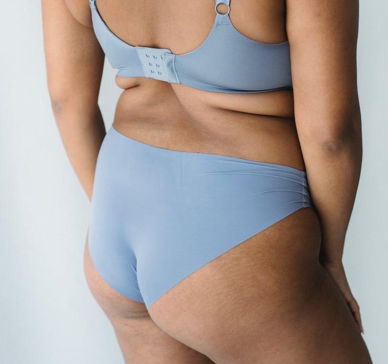 Ondas de choque en medicina estética Murcia: cicatrices, celulitis, lipedema, estrías, arrugas, piel