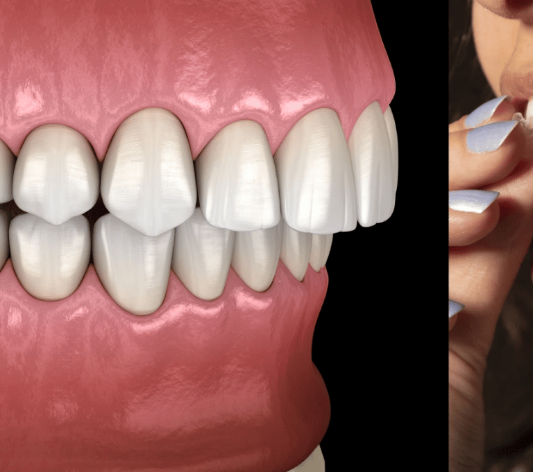 عيادة تركيب تقويم شفاف بالكويت