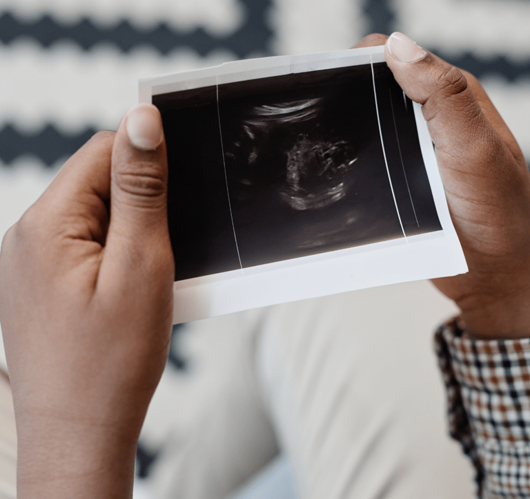 échographie obstétricale et suivi de grossesse par une sage femme libérale