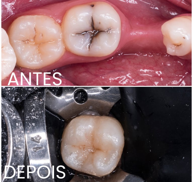 Clínica especializada em dentisteria e tratamento de cáries em Setúbal.