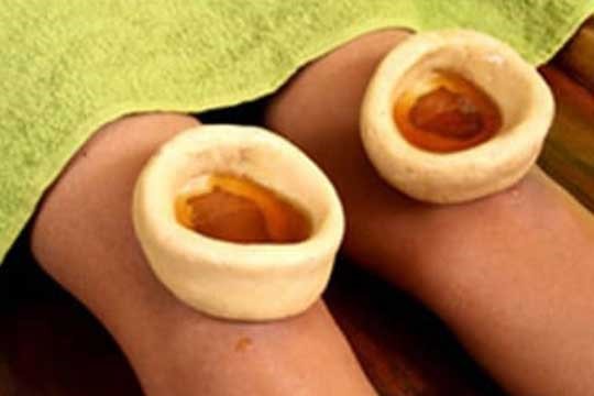 Janu Basti at HLC Ayurveda nature cure, bengaluru