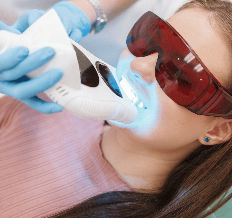 Clínica especializada em branqueamento dentário profissional em Setúbal.