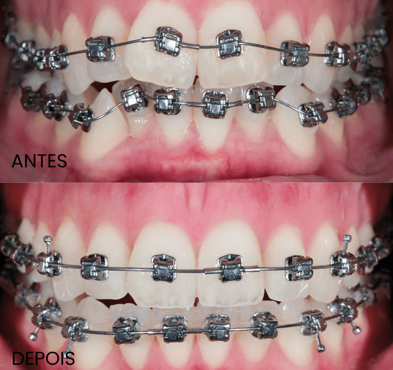 Clínica especializada em ortodontia e aparelhos dentários em Setúbal.