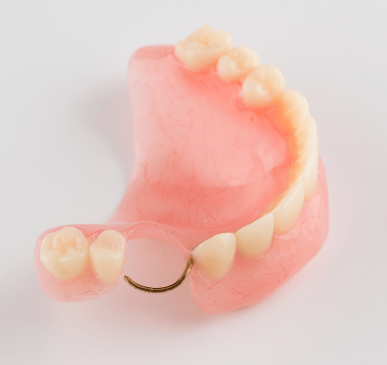 Clínica especializada em próteses dentárias removíveis em Setúbal.