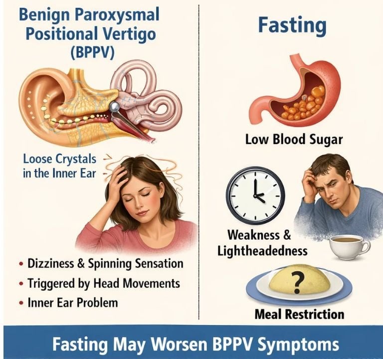 Benign Paroxysmal Positional Vertigo (BPPV)