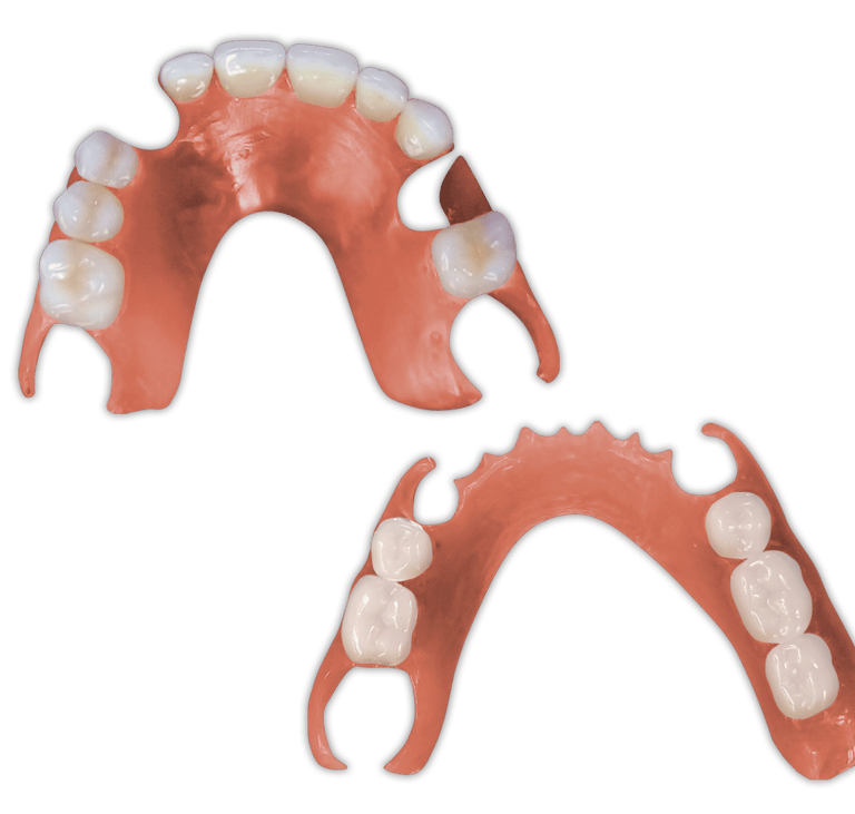 Protesis-Removible-Flexible-PartialFlex