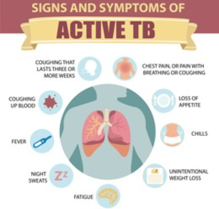 signs-and-symptoms-of-active-TB