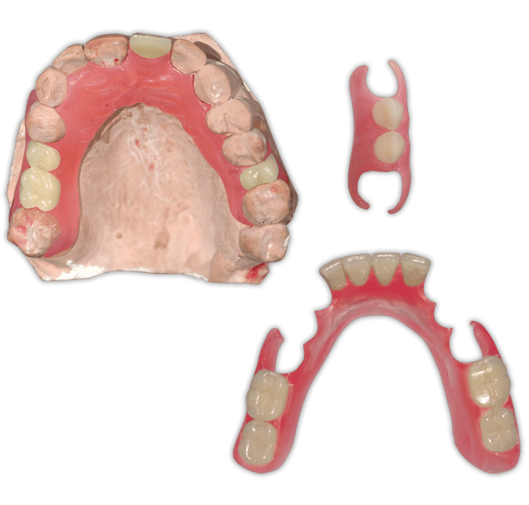 Protesis-Removible-Flexible-Valplast