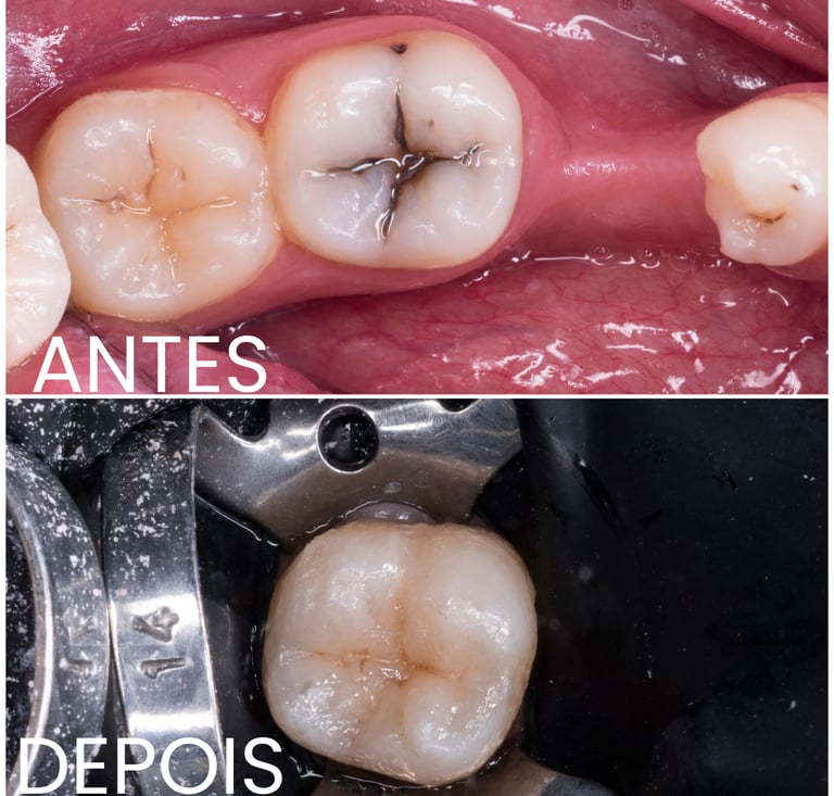 Clínica especializada em dentisteria e tratamento de cáries em Setúbal.
