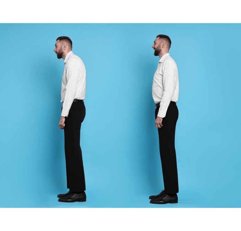 postura ipercifotica