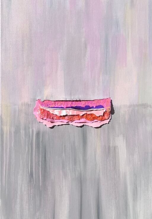 7 capas de la cesarea