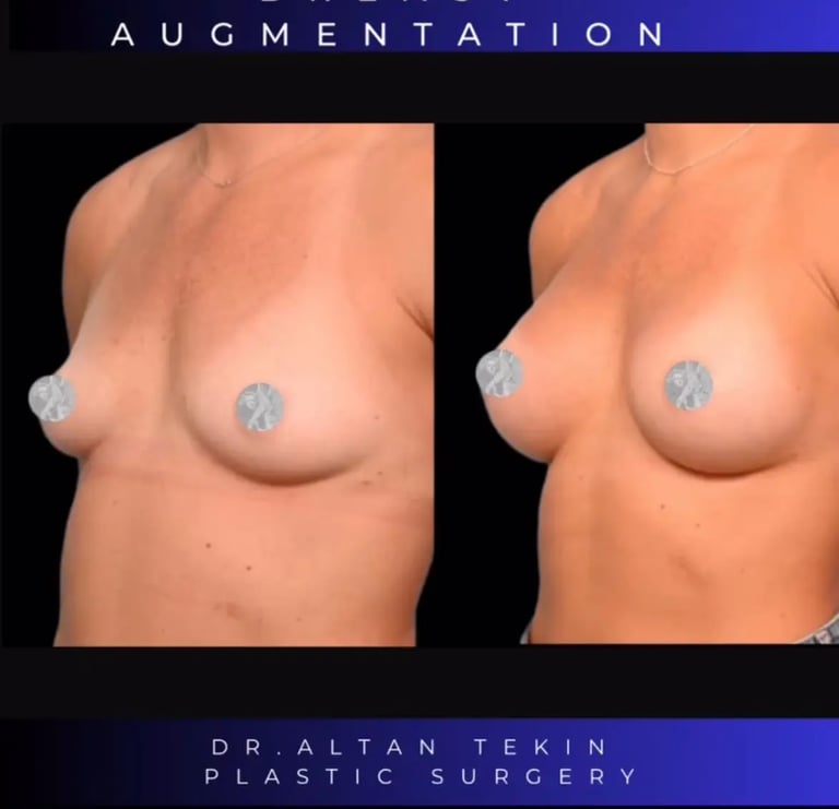 before after photos in Antalya, Türkiye