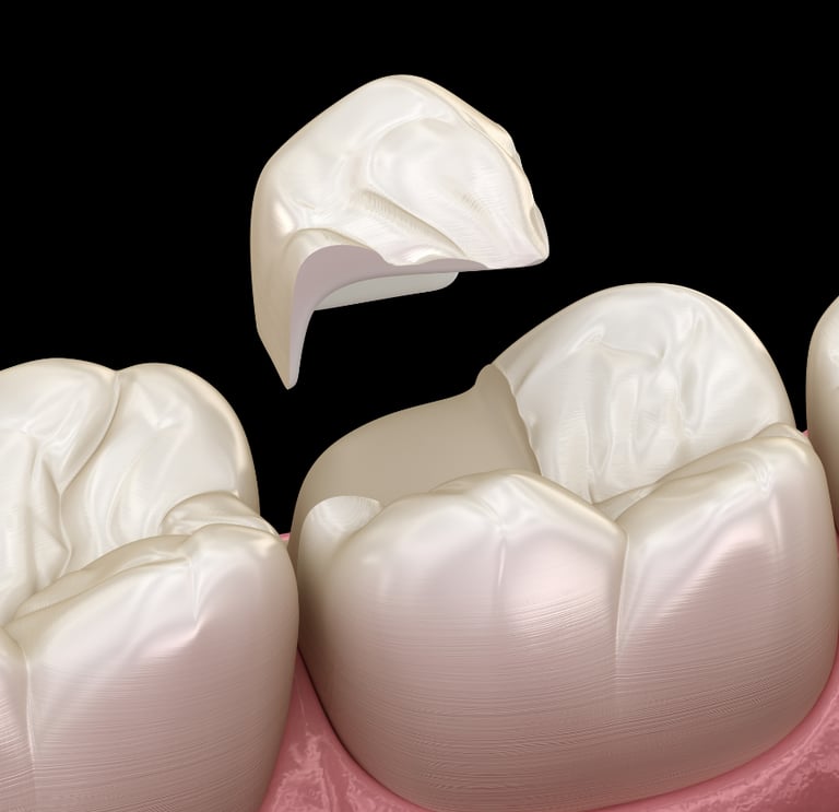 Dentist repairing a chipped tooth using dental bonding material in a clinical setting