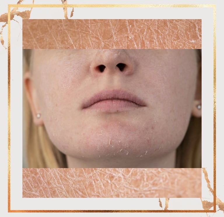 Dry Skin Care ray and rio's speciality clinic