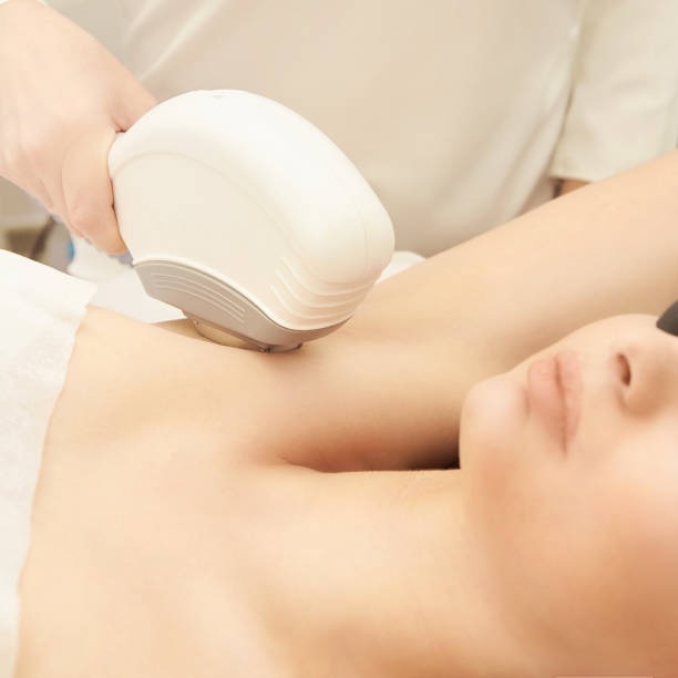 Diyarbakır lazer epilasyon uygulaması