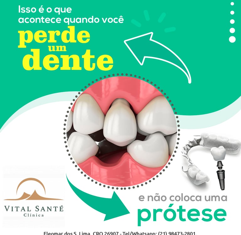 Perda de um dente