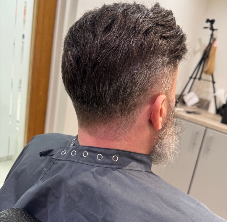 HairLabUK non surgical Hair Transplant in Hull