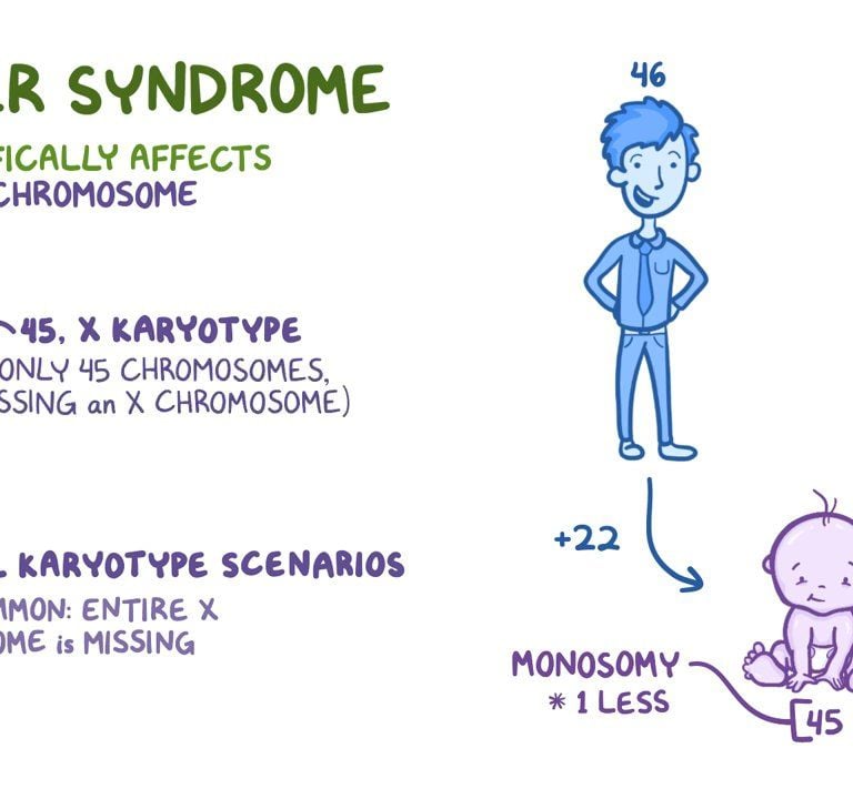 Turner Syndrome