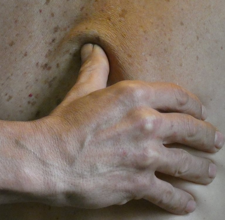 un térapeuthe exerce un impulsion vibratoire sur un trigger point