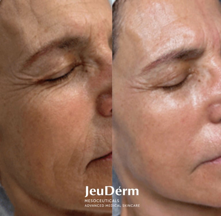 before and after from Jeudérm